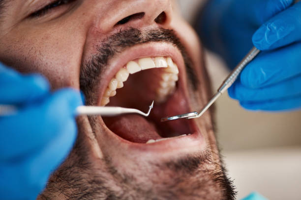 Best Dental Fillings (Composite and Amalgam)  in Mineralwells, WV